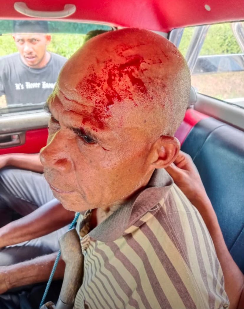 Kasus Pembacokan Markus Masauna Mandek di Polsek Wahai